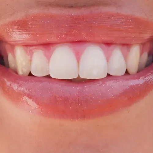 happy-beauty-and-lips-of-woman-with-smile-for-con-2026-03-25-05-11-38-utc