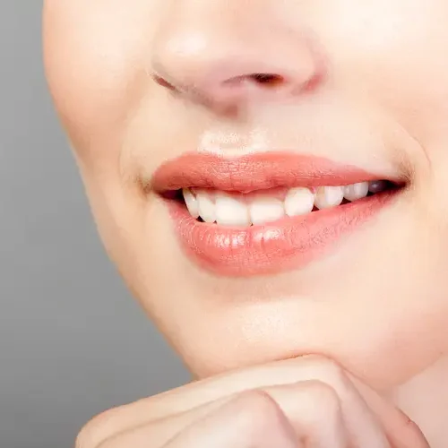 Clinique dentaire à Aix-en-Provence 5 - Clinique Dentaire Sextius perfect-natural-smiled-lips-makeup-close-up-2026-03-18-04-45-44-utc